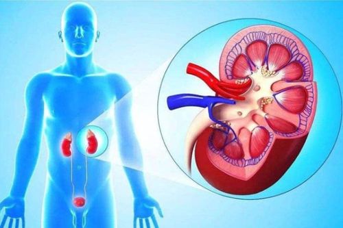 糖友冬季别乱补 这样饮食更健康